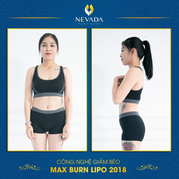 Review công nghệ giảm béo Max Burn Lipo 2019 có gì đặc biệt